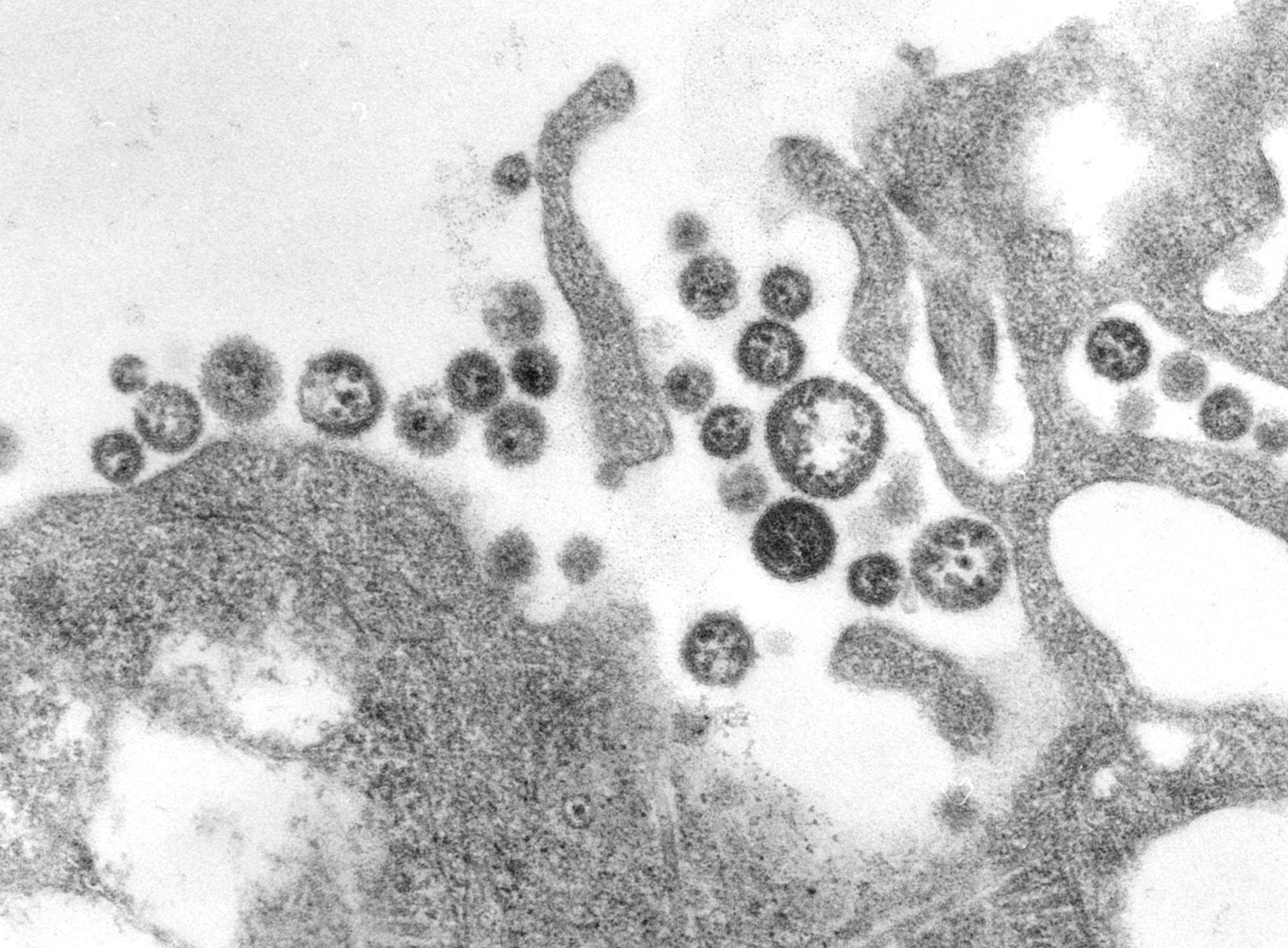 TEM micrograph of Lassa virus virions.