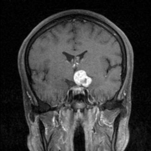 File:MRI CarioGIF1.gif