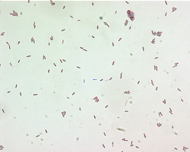 Clostridium botulinum spores stained with malachite green stain. From Public Health Image Library (PHIL). [7]