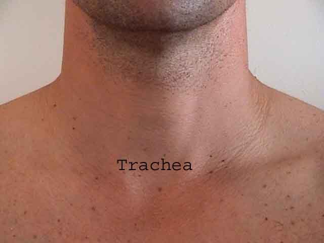 Lung trachea me.jpg