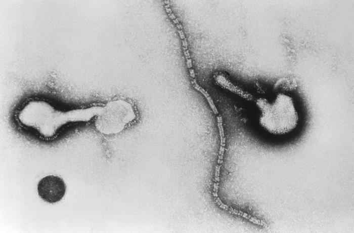 This transmission electron micrograph (TEM) depicts parainfluenza virions, and free filamentous nucleocapsid material. From Public Health Image Library (PHIL). [1]