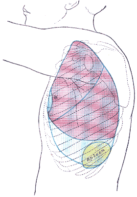 Side of thorax, showing surface markings for bones, lungs (purple), pleura (blue), and spleen (green).