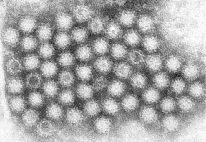 Transmission electron micrograph (TEM) revealed some of the ultrastructural morphology displayed by Norovirus virions. From Public Health Image Library (PHIL). [15]