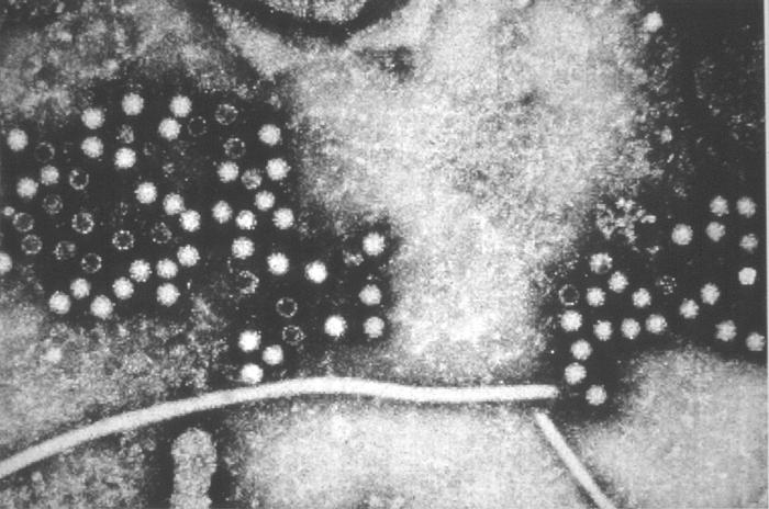 Electron micrograph depicts hepatitis-E viruses (HEV), provisionally classified as members of the Caliciviridae family. From Public Health Image Library (PHIL). [1]