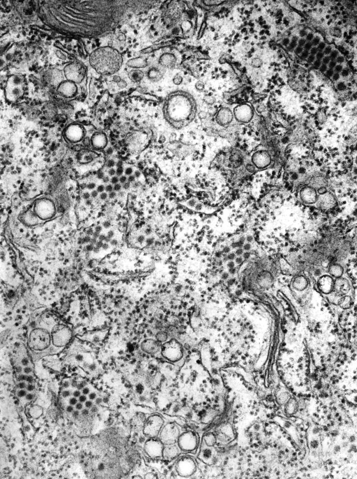 Transmission electron micrograph (TEM) reveals the presence of numerous St. Louis encephalitis (SLE) virions that were contained inside a central nervous system tissue sample. From Public Health Image Library (PHIL). [4]