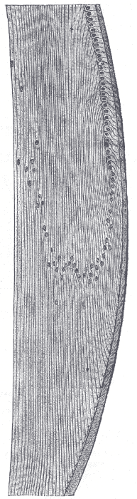 Section through the margin of the lens, showing the transition of the epithelium into the lens fibers.