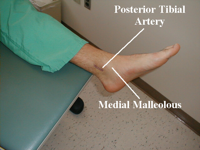Localization of posterior tibial artery.
