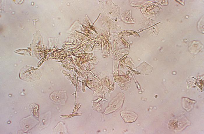 Wet mounted vaginal smear specimen, revealed the presence of Candida albicans, which had been extracted from a patient with vaginal candidiasis. From Public Health Image Library (PHIL). [9]