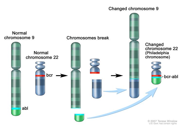 File:Philadelphia chromosome CML.jpg