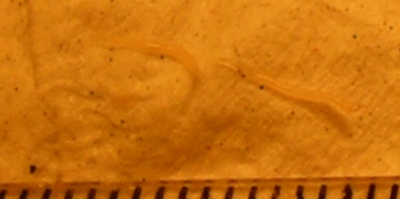Two pinworms, captured on emergence from the anus