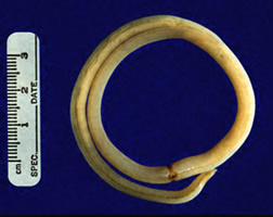 An adult female Ascaris worm