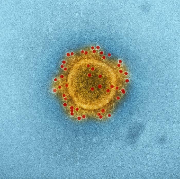 Middle East Respiratory Syndrome Coronavirus (MERS-CoV) virion. From Public Health Image Library (PHIL). [26]