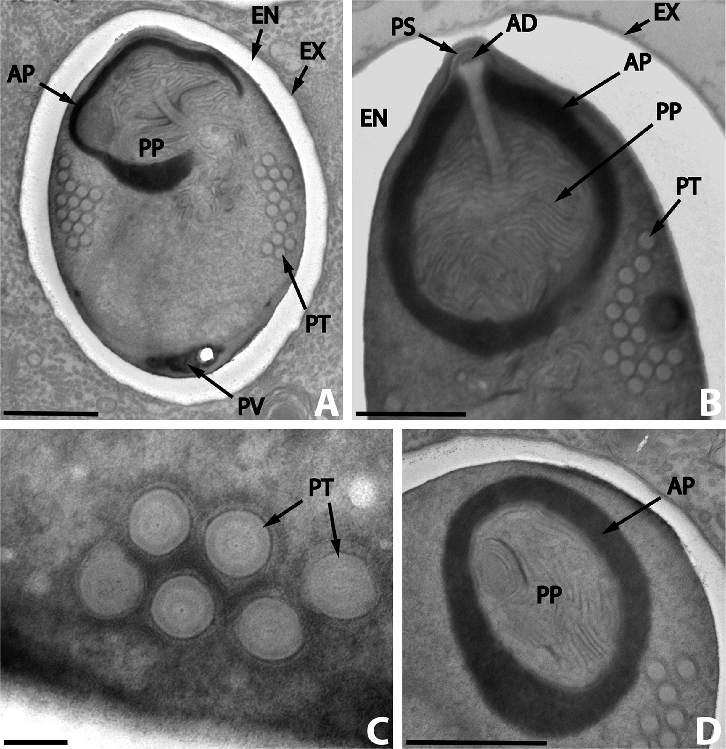 Dictyocoela diporeiae.A, meront and spore; B, spore wall; C, polar filament - By Andrew David Winters & Mohamed Faisal - Winters, A. D., Faisal, M. 2014. Molecular and ultrastructural characterization of Dictyocoela diporeiae n. sp. (Microsporidia), a parasite of Diporeia spp. (Amphipoda, Gammaridea). Parasite, 21, 26 doi:10.1051/parasite/2014028, CC BY 2.0, https://commons.wikimedia.org/w/index.php?curid=33448743
