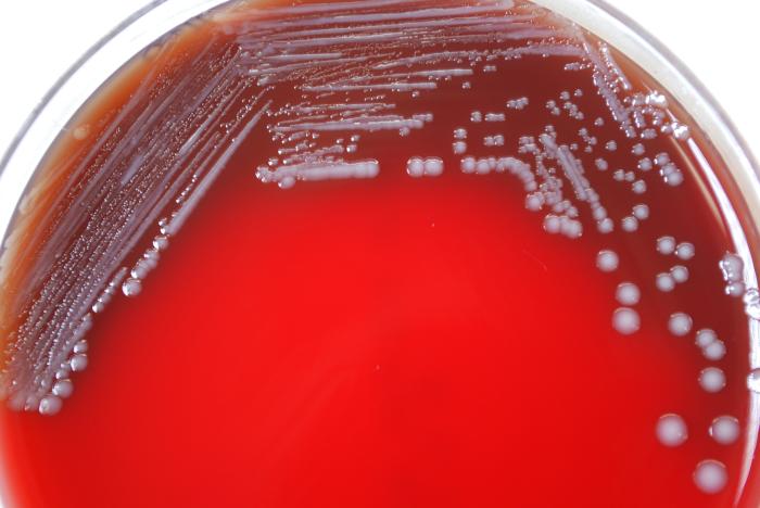 Gram-negative Yersinia pestis bacteria, grown on SBA 72hrs. From Public Health Image Library (PHIL). [6]