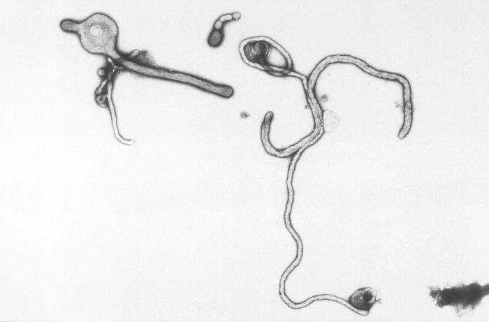Negatively-stained transmission electron micrograph (TEM) demonstrating the ultrastructural curvilinear morphologic features displayed by the Ebola virus from the Ivory Coast of Africa. Source: CDC microbiologist Charles Humphrey