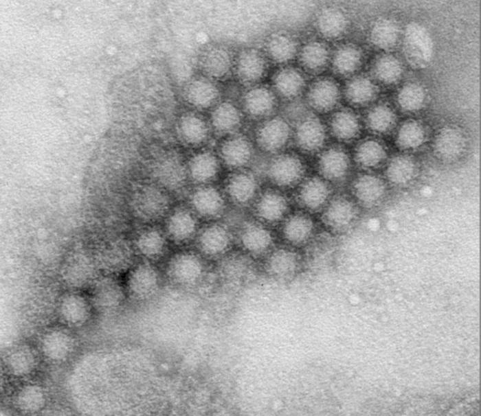 Transmission electron micrograph (TEM) revealed some of the ultrastructural morphology displayed by Norovirus virions. From Public Health Image Library (PHIL). [21]