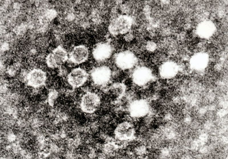 Electron micrograph of Parvoviruses in blood