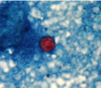 File:Safranin stain 3.png