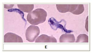 African trypanosomiasis 5