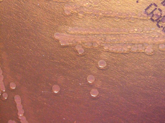 Gram-negative Yersinia pseudotuberculosis bacteria, cultured on a MacConkey agar (MAC) medium 24hrs (20x mag). From Public Health Image Library (PHIL). [3]