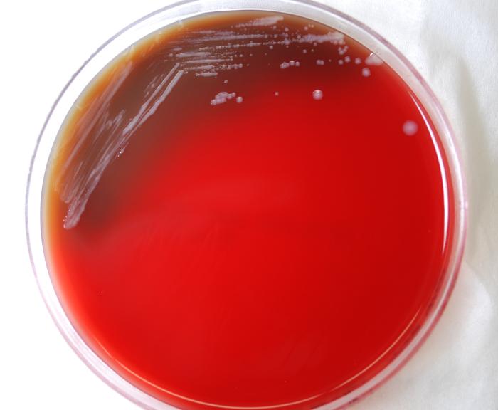 Colonial morphology displayed by Gram-negative Burkholderia mallei bacteria, on a medium of sheep’s blood agar (SBA). From Public Health Image Library (PHIL). [3]
