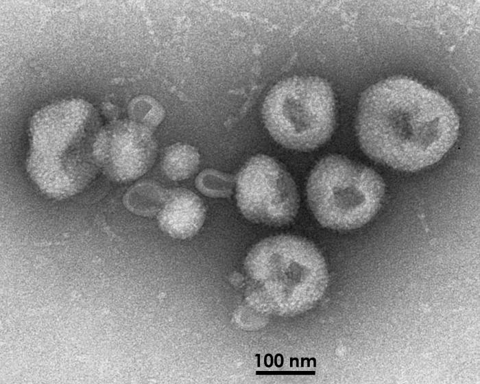 This transmission electron micrograph depicted eight virions (viral particles) of a newly-discovered virus, which was determined to be a member of the genus, Arenavirus. A cause of fatal hemorrhagic fever, it was confirmed that this virus was responsible for causing illness in five South Africans, four of whom died having succumbed to its devastating effects. From Public Health Image Library (PHIL). [1]