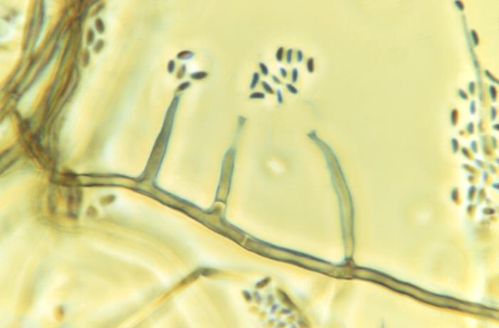 Photomicrograph reveals morphologic details displayed by the fungal organism, Phialophora parasitica, which is known to be a cause of chromoblastomycosis (1125x mag). From Public Health Image Library (PHIL). [1]