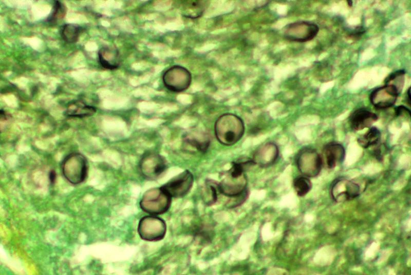 P. jirovecii cysts in tissue