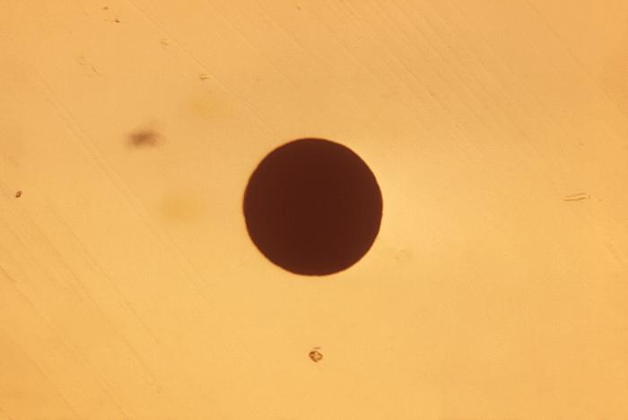 This photograph depicted a single Gardnerella vaginalis, formerly Haemophilus vaginalis, or Corynebacterium vaginalis, bacterial colony. The vagina is normally colonized by Lactobacillus spp., which help to regulate the region’s pH, maintaining it in the low range, thereby, inhibiting the growth of potentially-pathogenic organisms. The Gram-positive Gardnerella vaginalis bacterium is one such organism, and is a common cause for bacterial vaginosis (BV). Adapted from CDC