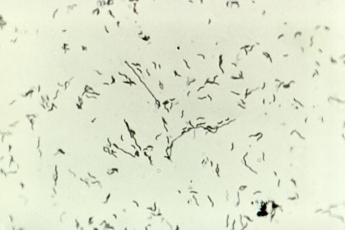 Campylobacter jejuni bacteria revealing characteristic “thin”, “comma-“, “S-“ or “gull winged-shaped” forms. From Public Health Image Library (PHIL). [2]