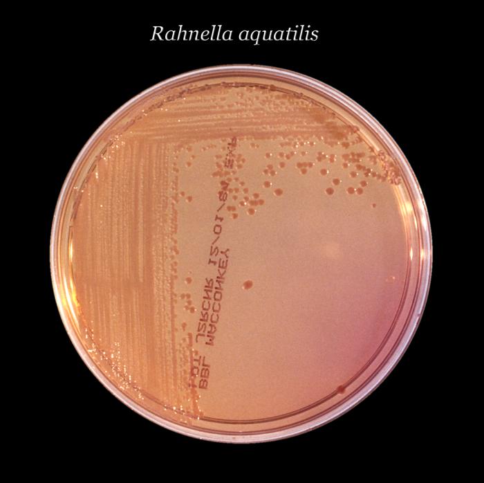 MacConkey agar culture plate with Rahnella aquatilis bacteria (24hrs). From Public Health Image Library (PHIL). [1]