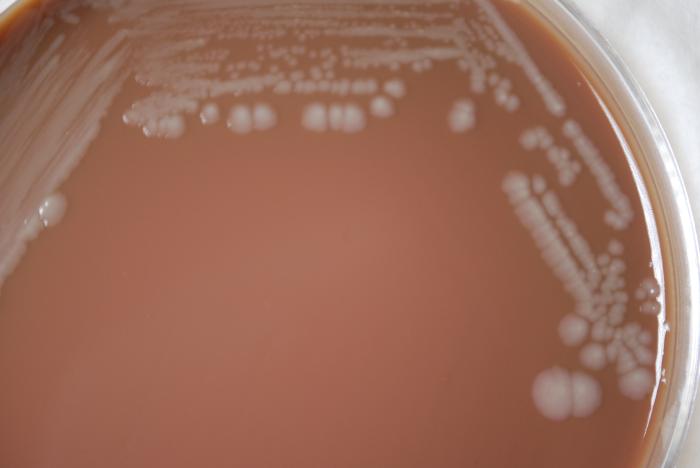 Colonial morphology displayed by Gram-negative Burkholderia mallei bacteria, grown on a medium of chocolate agar. From Public Health Image Library (PHIL). [3]