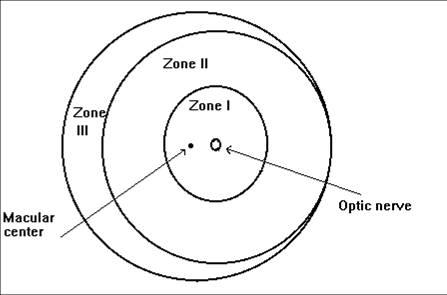 Zones of the retina in ROP