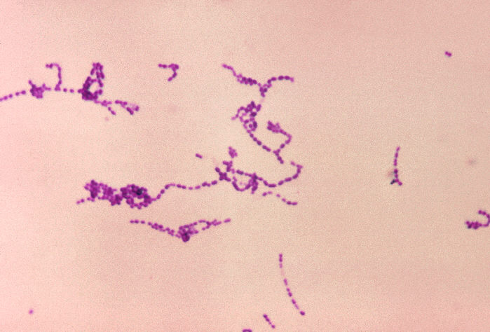 File:Group A streptococcus29.jpeg