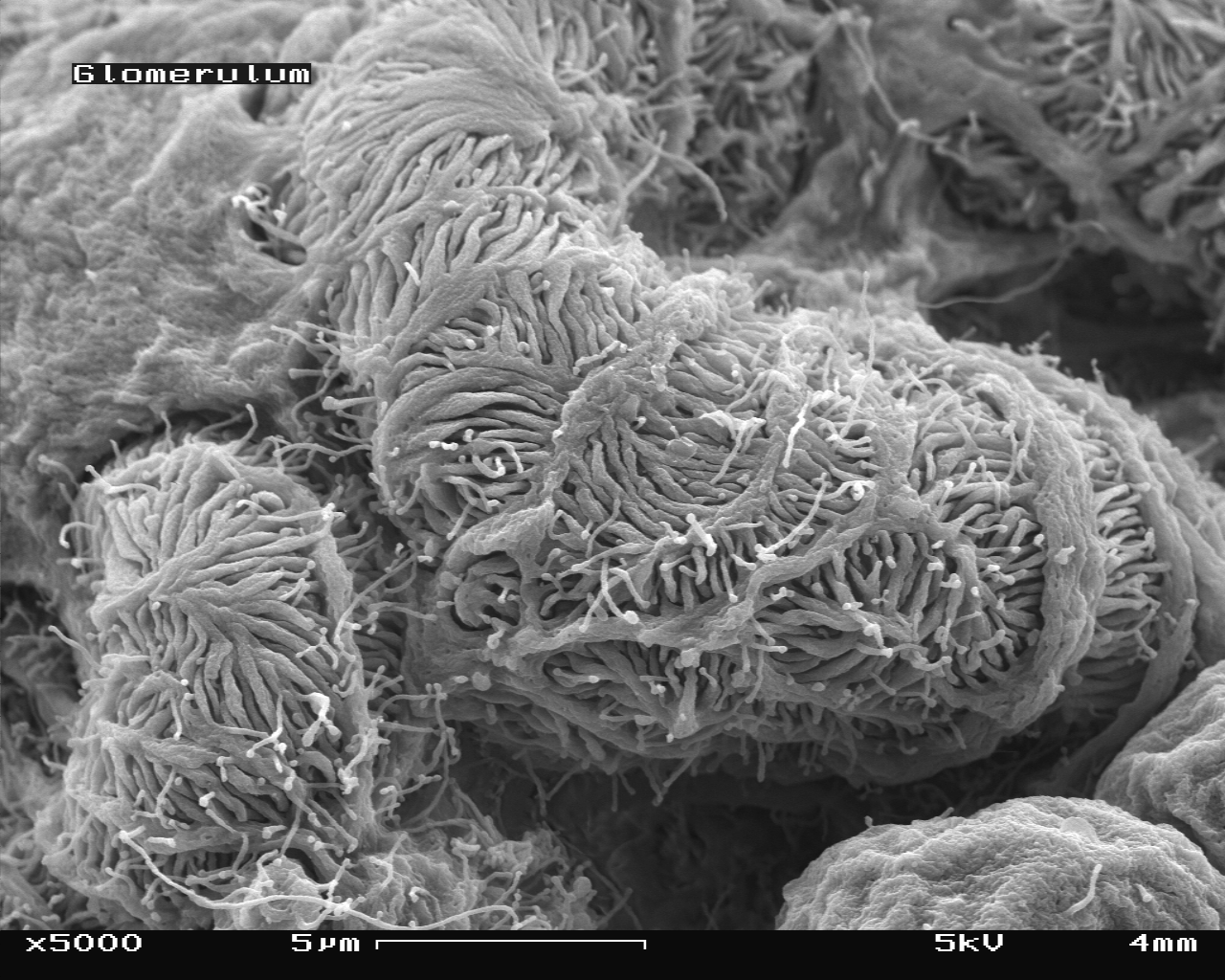 Mouse glomerulus in the SEM, magnification 5,000x