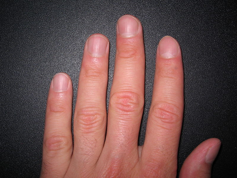 Normal fingernails