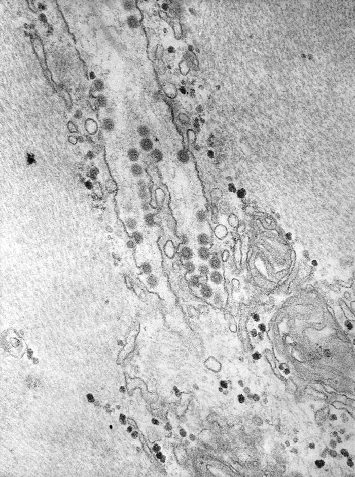 Transmission electron micrograph (TEM) reveals the of numerous Semliki Forest virus virions in a muscle tissue specimen. From Public Health Image Library (PHIL). [1]