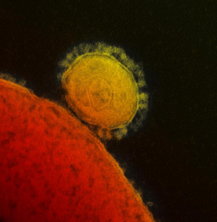 TEM reveals ultrastructural details exhibited by a single, spherical-shaped Middle East Respiratory Syndrome Coronavirus (MERS-CoV) virion. From Public Health Image Library (PHIL). [16]