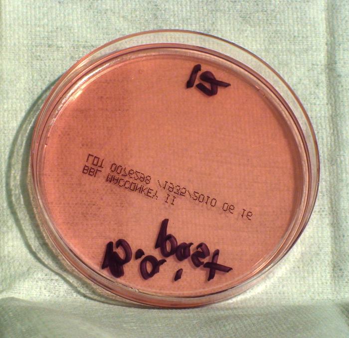 Light colonial growth displayed by Gram-positive, Pasteur strain, Bacillus anthracis bacteria, which was grown on a medium of MacConkey agar, for a 24 hour time period, at a temperature of 37°C.”Adapted from Public Health Image Library (PHIL), Centers for Disease Control and Prevention.[21]