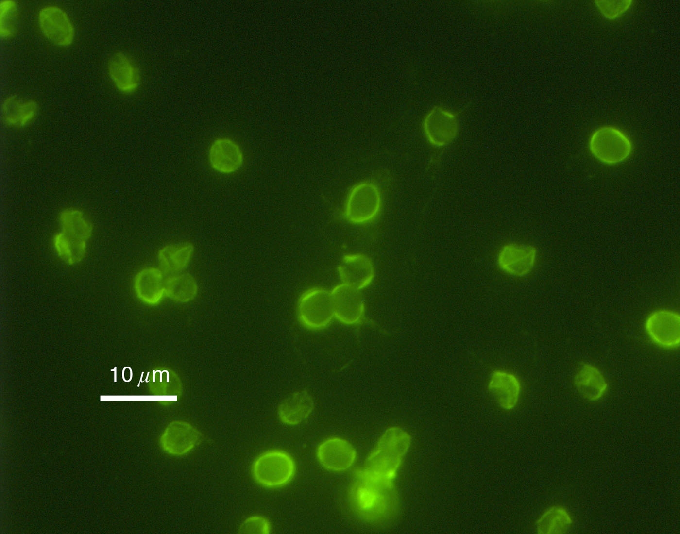 Immunofluorescence image of C. parvum oocysts.