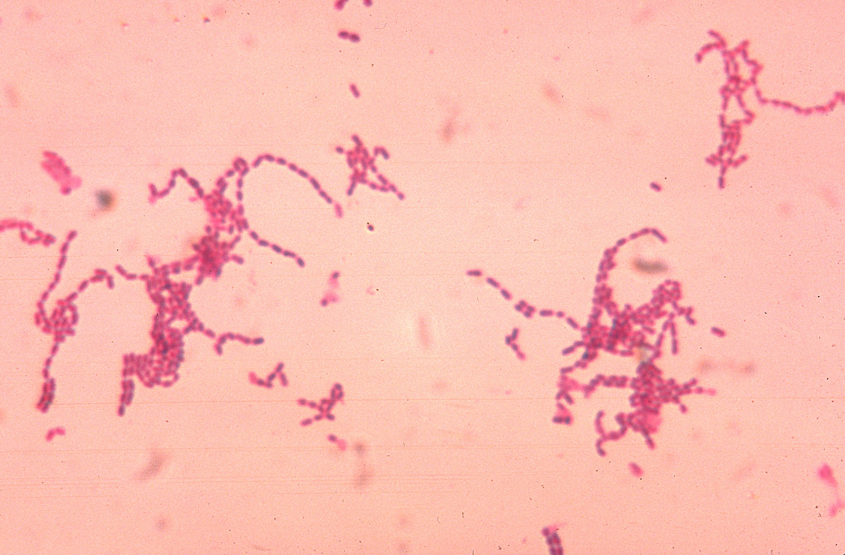 Peptostreptococcus spp. growing in characteristic chain formations.