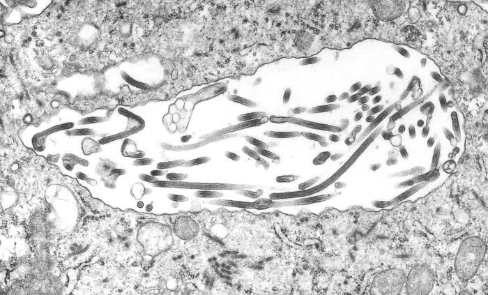 This 1995 transmission electron micrograph (TEM) revealed some of the ultrastructural morphologic changes in this tissue sample isolate brought on due to an Ebola hemorrhagic fever infection, including the presence of numbers of Ebola virions.