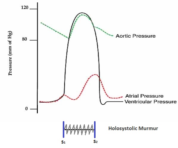 MR pressure graph.jpg