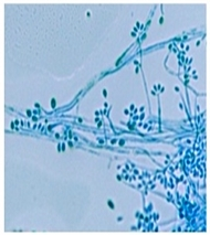 A micrograph of Sporothrix schenckii conidia stained with lactophenol cotton blue