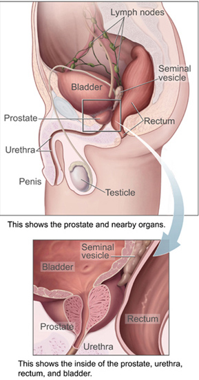 Prostatitis a férfiak órájában