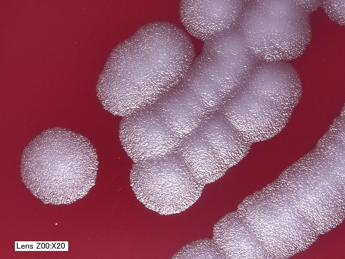 File:Bacillus anthracis18.jpeg