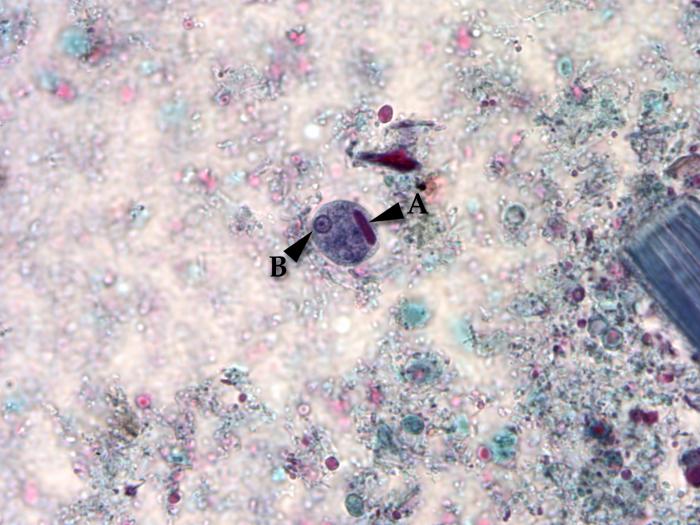 Entamoeba histolytica cyst. Adapted from Public Health Image Library (PHIL). [1]