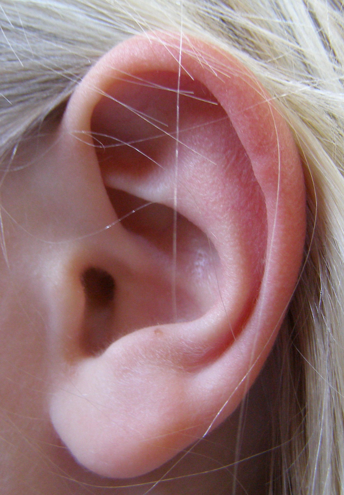Left ear