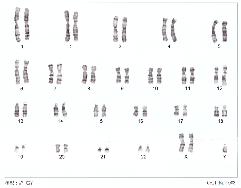 File:Human chromosomesXXY01.png