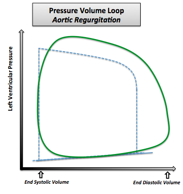 Pressure-volume loop in aortic regurgitation. Note that the normal pressure-volume diagram is in dotted line.